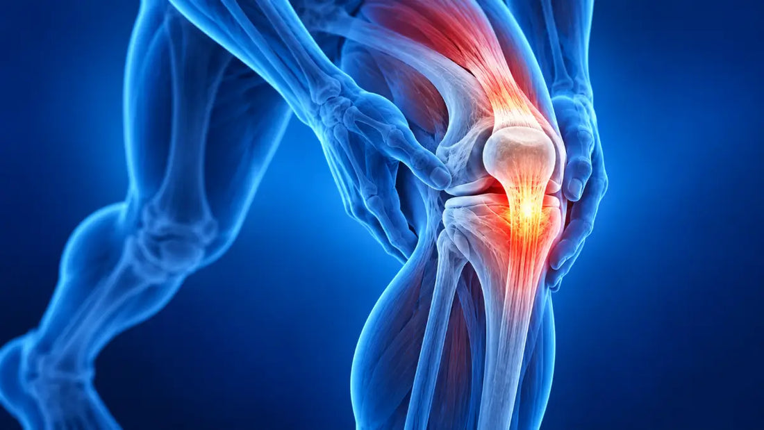 Anatomical illustration of knee tendonitis showing highlighted tendons around the kneecap as a person holds their knee.
