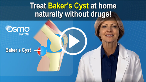 Treat Baker's Cyst naturally at home with the OSMO Patch